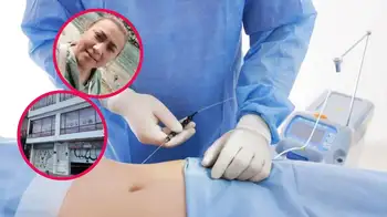 El caso de Yuliza Toloza reabre el debate sobre la lipólisis láser y los riesgos. ¿Qué es la lipólisis láser, el procedimiento al que se sometió Yulixa Toloza antes de desaparecer?