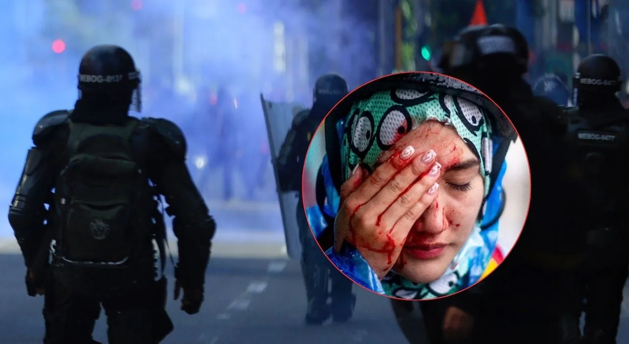 Leidy Natalia perdió uno de sus ojos en las protestas de abril de 2021 Los años de cárcel que tendrá que pagar agente del Esmad por una lesión ocular