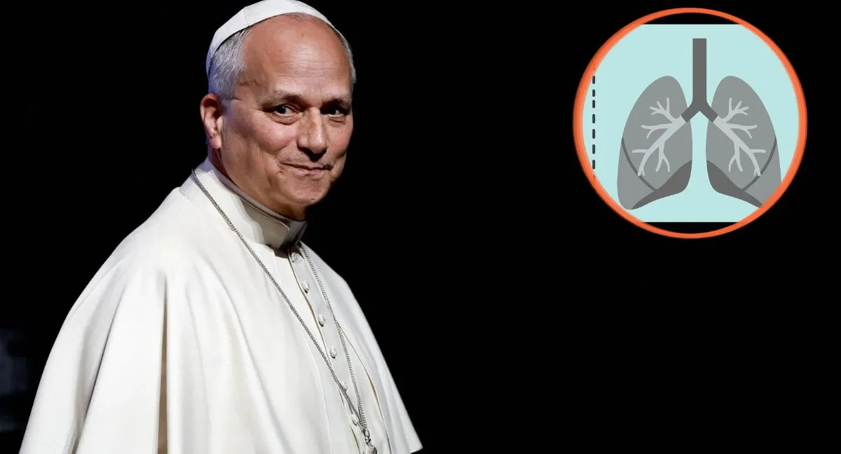 Papa León XIV Este es el adenocarcinoma pulmonar, el cáncer por el que operaron al papa León XIV