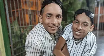 Siameses de Ecuador murieron en un hospital de Zipaquirá (Cundinamarca). José Luis y José Armando Cevallos, los siameses de Ecuador, murieron en Colombia a los 27 años